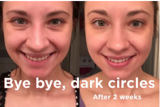 Image of Pretty Cowry Vitamin C Serum Facial Cream – Organic Anti-Aging Serum For Skin Treatment