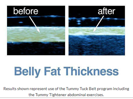Image of Original Tummy Tuck Belt